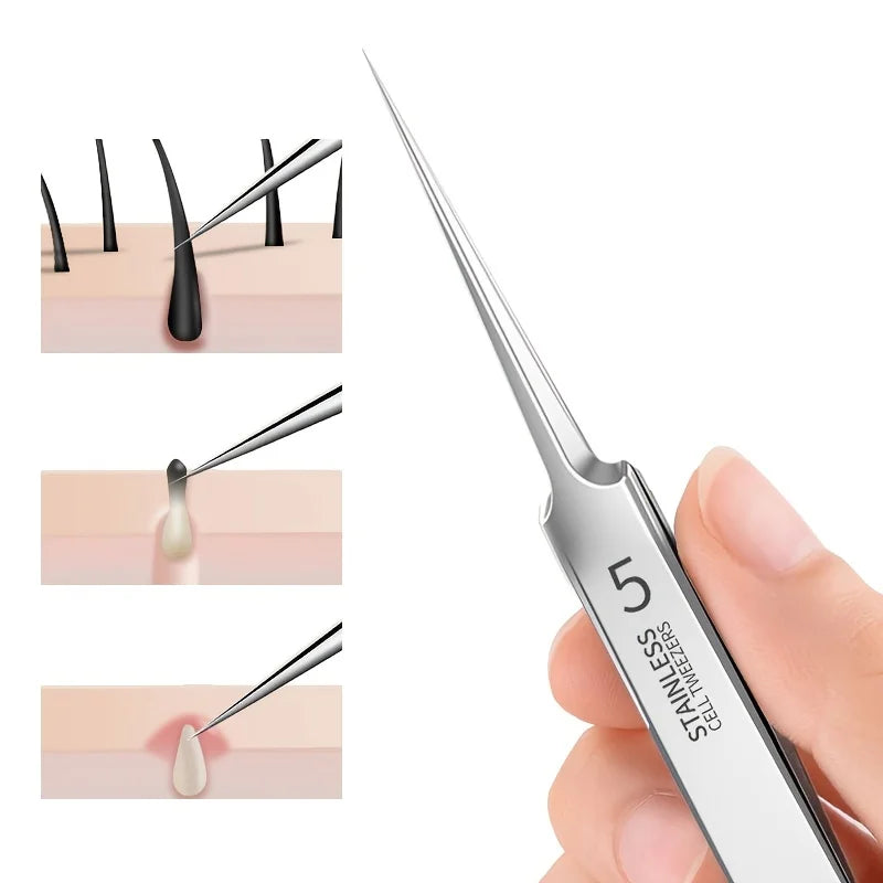 Stainless Steel Blackhead Remover Tweezers